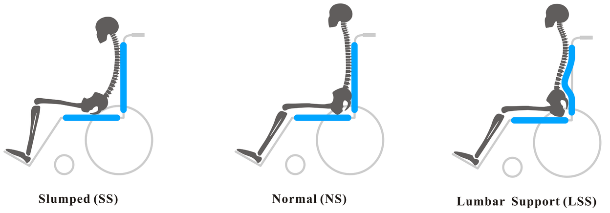 Wheelchair Positioning to Prevent Back Pain