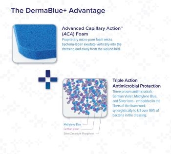 hydrofera blue ready foam dressing 4 x 5 Hydrofera Blue Ready Antibacterial Foam Dressing 4