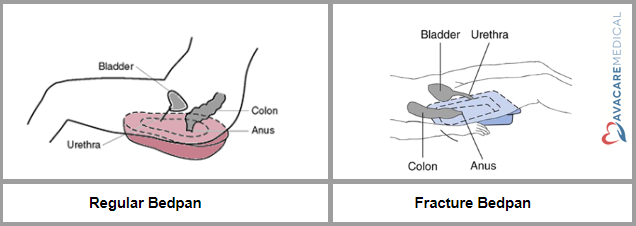 sitting on a regular bedpan vs. lying on a fracture bedpan